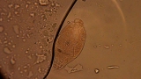 Rotifer