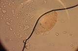 Rotifer