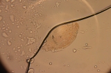 Rotifer