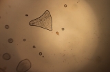 Rotifer