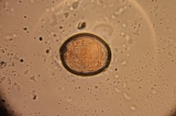 Rotifer