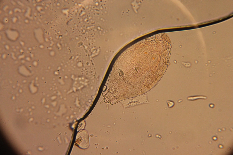 Rotifer